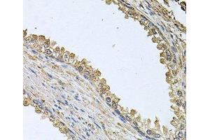 Immunohistochemistry of paraffin-embedded Human prostate using MEMO1 Polyclonal Antibody at dilution of 1:100 (40x lens). (MEMO1 抗体)