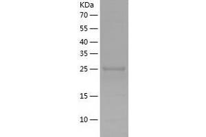 TGFBRAP1 Protein (AA 601-860) (His tag)