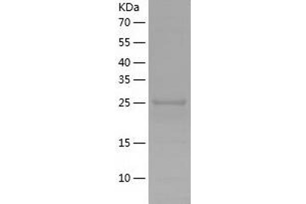 TGFBRAP1 Protein (AA 601-860) (His tag)