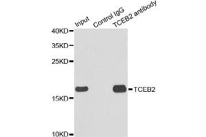 Immunoprecipitation analysis of 150ug extracts of MCF7 cells using 3ug TCEB2 antibody (ABIN1876550). (TCEB2 抗体)