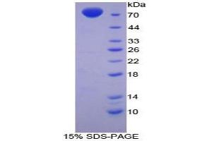 SDS-PAGE analysis of Chicken MSE Protein. (MSE 蛋白)