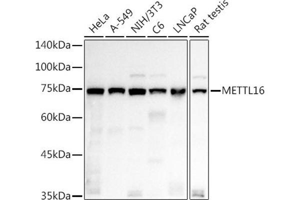 METTL16 Antikörper  (AA 263-562)