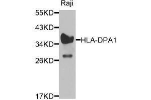 Western blot analysis of extracts of raji cells, using HLA-DPA1 antibody. (HLA-DPA1 抗体)