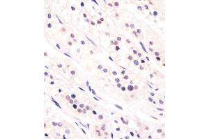 Antibody staining CDC73 in human adrenal gland tissue sections by Immunohistochemistry (IHC-P - paraformaldehyde-fixed, paraffin-embedded sections). (HRPT2 抗体  (AA 132-161))