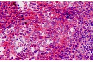 Immunohistochemistry (IHC) image for anti-Sequestosome 1 (SQSTM1) (AA 383-409) antibody (ABIN6750865)