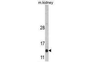 Image no. 1 for anti-DnaJ (Hsp40) Homolog, Subfamily C, Member 19 (DNAJC19) (Middle Region) antibody (ABIN452917) (DNAJC19 抗体  (Middle Region))