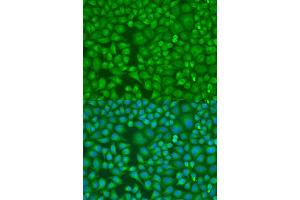 Immunofluorescence analysis of U2OS cells using LLGL2 antibody (ABIN6131794, ABIN6143262, ABIN6143265 and ABIN6224298) at dilution of 1:100. (LLGL2 抗体  (AA 620-819))