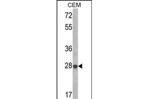 Western blot analysis of IGFBP6 Antibody (C-term) (ABIN390729 and ABIN2841001) in CEM cell line lysates (35 μg/lane). (IGFBP6 抗体  (C-Term))