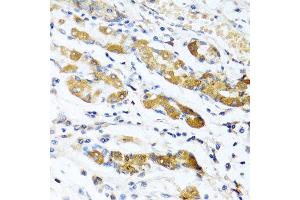 Immunohistochemistry of paraffin-embedded human stomach using OGN antibody at dilution of 1:100 (40x lens). (OGN 抗体)