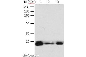 Western blot analysis of 293T cell and mouse brain tissue, A549, Hela, A172 and HT-29 cell, using RAB6A Polyclonal Antibody at dilution of 1:650 (RAB6A 抗体)