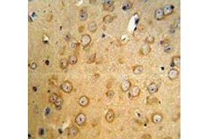 VHL antibody IHC analysis in formalin fixed and paraffin embedded mouse brain tissue. (VHL 抗体  (AA 181-210))