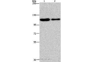 Western blot analysis of Hela and A172 cell, using PDE4A Polyclonal Antibody at dilution of 1:300 (PDE4A 抗体)