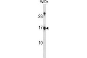 Western blot analysis in WiDr cell line lysates (35ug/lane) using NDP kinase A Antibody . (NME1 抗体  (Middle Region))