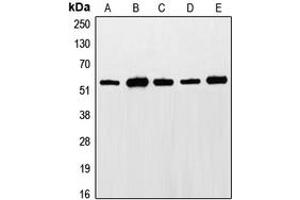 Western blot analysis of ETS1 (pT38) expression in LO2 (A), Jurkat (B), HepG2 (C), NIH3T3 (D), rat liver (E) whole cell lysates.