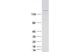 PPP1R13B Protein (Myc-DYKDDDDK Tag)