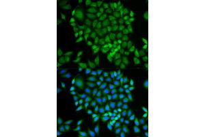 Immunofluorescence analysis of MCF-7 cells using GLRX antibody. (Glutaredoxin 1 抗体)