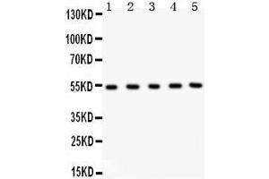 Anti- MMP3 Picoband antibody, Western blotting All lanes: Anti MMP3  at 0. (MMP3 抗体  (C-Term))