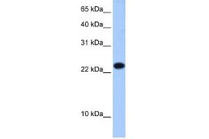 WB Suggested Anti-EIF4E3 Antibody Titration:  0. (EIF4E3 抗体  (Middle Region))