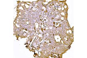 IHC analysis of Prothrombin using anti-Prothrombin antibody (ABIN7602705). (Prothrombin Fragment 2 (AA 97-124) 抗体)