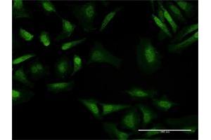 Immunofluorescence of purified MaxPab antibody to BAHD1 on HeLa cell. (BAHD1 抗体  (AA 1-780))
