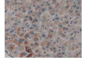 IHC-P analysis of Human Liver Tissue, with DAB staining. (PLAT 抗体  (AA 36-126))
