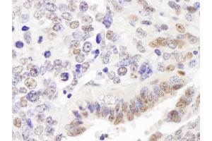 Immunohistochemistry (IHC) image for anti-GATA Zinc Finger Domain Containing 2A (GATAD2A) (AA 573-633) antibody (ABIN7448708) (GATAD2A 抗体  (AA 573-633))