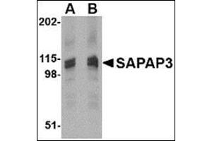 Western blot analysis of SAPAP3 in rat brain tissue lysate with this product at (A) 1 (B) 2 μg/ml. (DLGAP3 抗体  (C-Term))