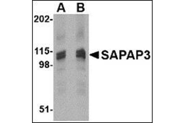 DLGAP3 Antikörper  (C-Term)