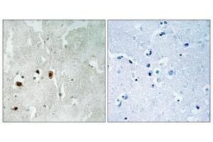 Immunohistochemistry analysis of paraffin-embedded human brain tissue using Tip60 (Phospho-Ser90) antibody. (KAT5 抗体  (pSer90))