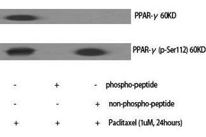 Western Blot (WB) analysis of specific cells using PPAR-gamma Polyclonal Antibody. (PPARG 抗体  (Thr2638))