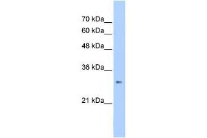 WB Suggested Anti-ING1 Antibody Titration:  2. (ING1 抗体  (C-Term))