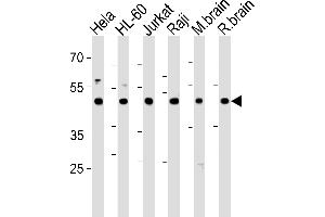 Western blot analysis in Hela,HL-60,Jurkat,Raji cell line and mouse brain,rat brain tissue lysates (35ug/lane). (CTBP1 抗体  (C-Term))
