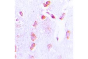 Immunohistochemical analysis of BCL2 (pT69) staining in human brain formalin fixed paraffin embedded tissue section. (Bcl-2 抗体  (pSer69))