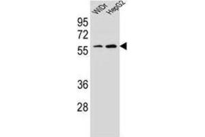 Western Blotting (WB) image for anti-Homeobox A10 (HOXA10) antibody (ABIN2995594) (HOXA10 抗体)