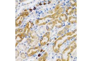 Immunohistochemistry of paraffin-embedded rat kidney using PGRMC1 antibody. (PGRMC1 抗体  (AA 44-195))