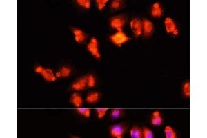 Immunofluorescence analysis of HeLa cells using HOXA11 Polyclonal Antibody at dilution of 1:100 (40x lens). (Homeobox A11 抗体)