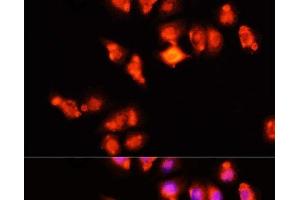 Immunofluorescence analysis of HeLa cells using HOXA11 Polyclonal Antibody at dilution of 1:100 (40x lens). (Homeobox A11 抗体)