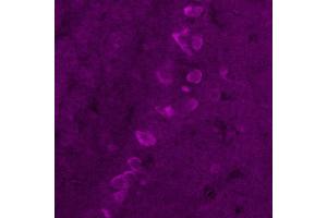 Immunohistochemistry (IHC) image for anti-Corticotropin Releasing Hormone (CRH) antibody (ABIN7456207) (CRH 抗体)