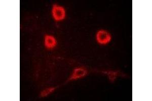Immunofluorescent analysis of CD212 staining in MCF7 cells. (IL12RB1 抗体)