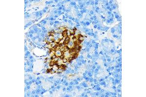 Immunohistochemistry of paraffin-embedded rat pancreatic islet using Insulin Rabbit mAb (ABIN7267886) at dilution of 1:100 (40x lens). (Insulin 抗体)