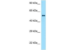 WB Suggested Anti-Zbtb37 Antibody   Titration: 1.