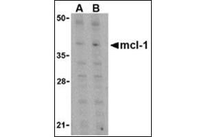 Western blot analysis of Mcl-1 in Raji cell lysates with this product at (A) 1 and (B) 2 μg/ml. (MCL-1 抗体  (C-Term))