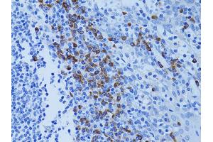 Immunohistochemistry of paraffin-embedded human tonsil using ATG7 antibody. (ATG7 抗体)