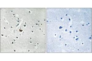 Immunohistochemistry analysis of paraffin-embedded human brain, using PLD2 (Phospho-Tyr169) Antibody. (Phospholipase D2 抗体  (pTyr169))