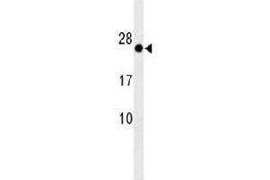 GAGE12F antibody western blot analysis in HepG2 lysate (G Antigen 12F 抗体  (AA 1-30))