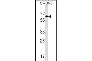 Western blot analysis in SK-BR-3 cell line lysates (35ug/lane). (TRIP4 抗体  (AA 194-222))