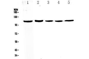Western blot analysis of CP110 using anti-CP110 antibody . (CP110 抗体  (AA 51-284))