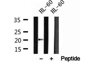 Western blot analysis of extracts of HL-60 cells, using Centrin 1 antibody. (Centrin 1 抗体  (Internal Region))