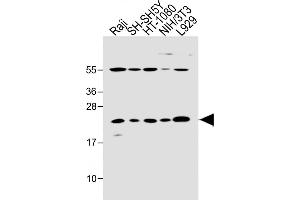 All lanes : Anti-Bax Antibody (BH3 Domain Specific) at 1:2000 dilution Lane 1: Raji whole cell lysate Lane 2: SH-SH5Y whole cell lysate Lane 3: HT-1080 whole cell lysate Lane 4: NIH/3T3 whole cell lysate Lane 5:  whole cell lysate Lysates/proteins at 20 μg per lane. (BAX 抗体  (AA 41-76))