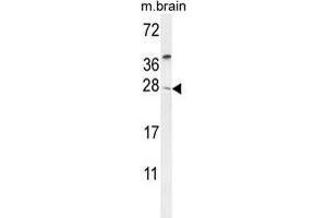 TIMP4 Antibody (Center) western blot analysis in mouse brain tissue lysates (35 µg/lane). (TIMP4 抗体  (Middle Region))
